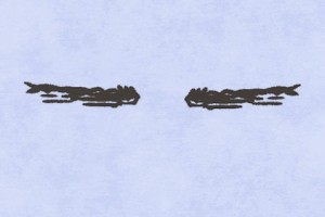 男人脸上什么地方的痣不能点