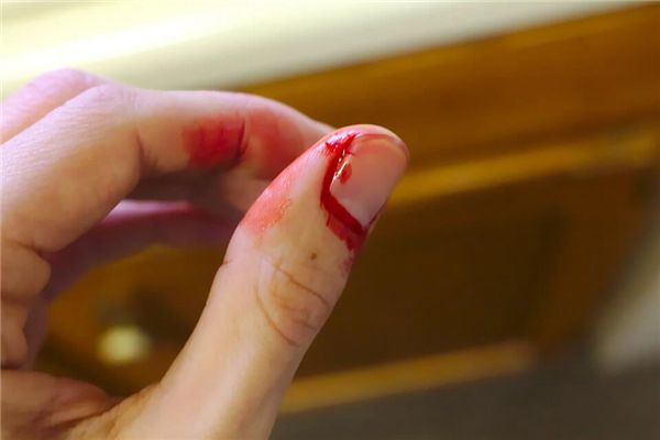 孕妇梦见别人流血